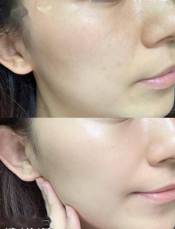 怎么让自己的脸部皮肤越来越白 1c05bbb822184d8eaf18b835fe9f4457.jpeg