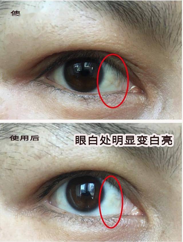 更值得一提的是,从眼底出发也能改善眼白状态,  眼白和眼珠达到清澈