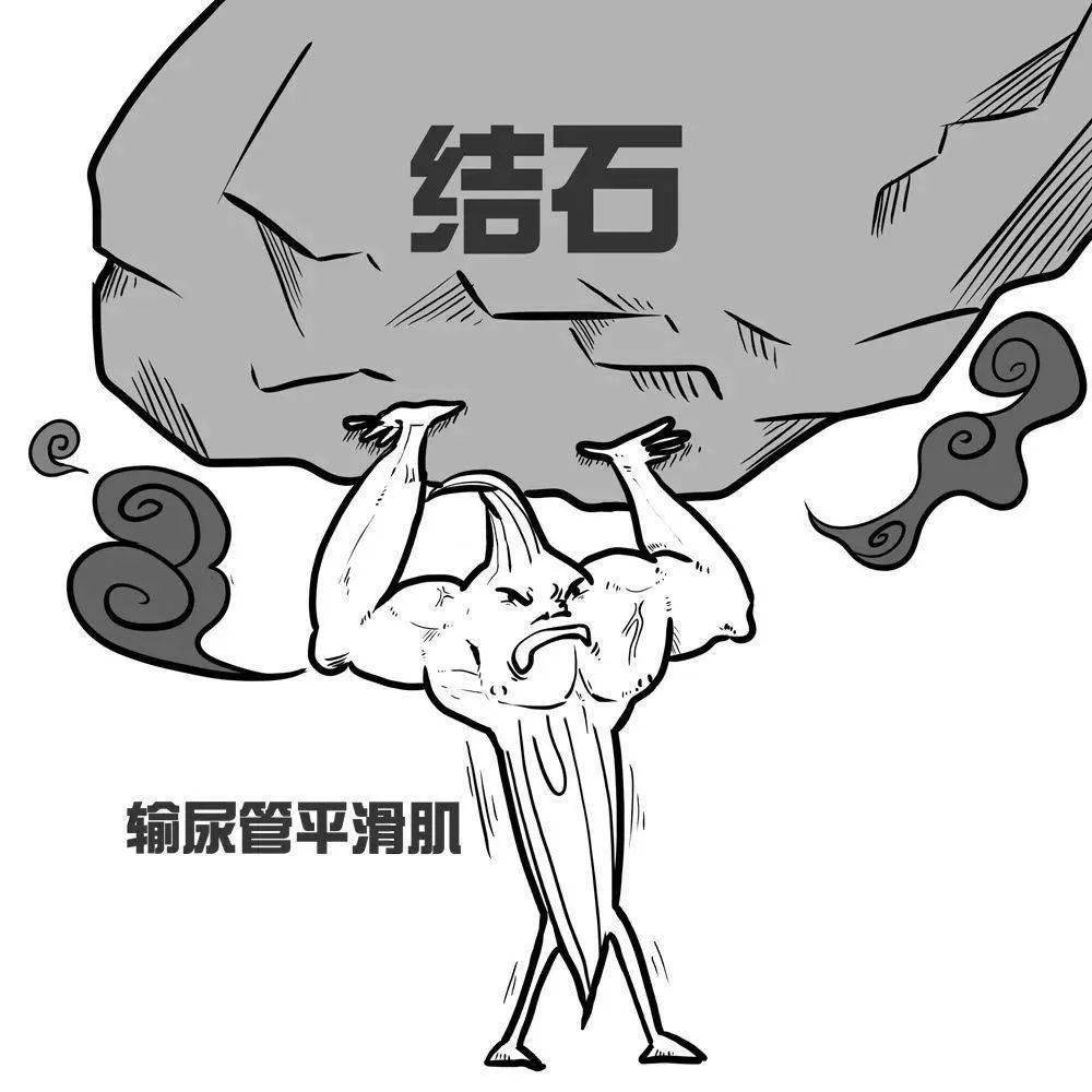 几率|【健康送】肾结石,为什么每逢夏天你就来?