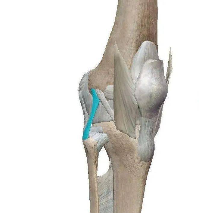 膝关节外侧副韧带不易损伤,因为在伸膝位,膝外侧关节囊,股二头肌腱