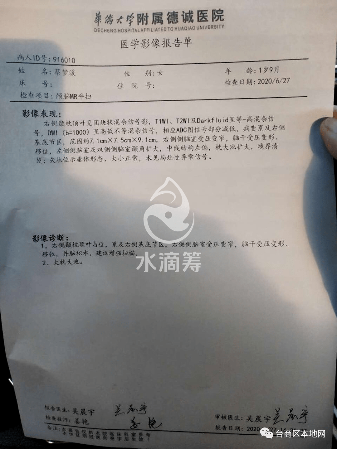 张坂活泼可爱的1岁多幼儿突患脑肿瘤恳求大家助她度过难关