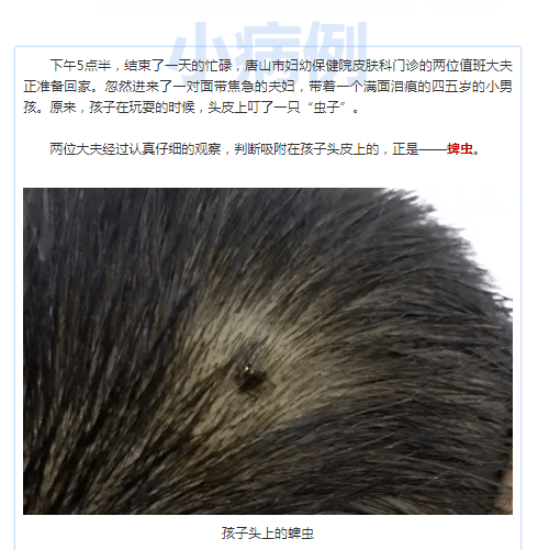 7476c4a835004dcbad36c270f74d74c9.png