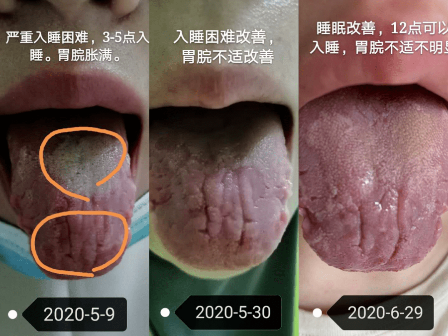 针灸后每晚睡前哭20分钟才能好好入睡,这是怎么回事?