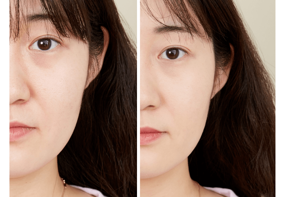 皮肤|团购丨皮肤干净不暗沉，多亏了这个69块的宝藏好物！