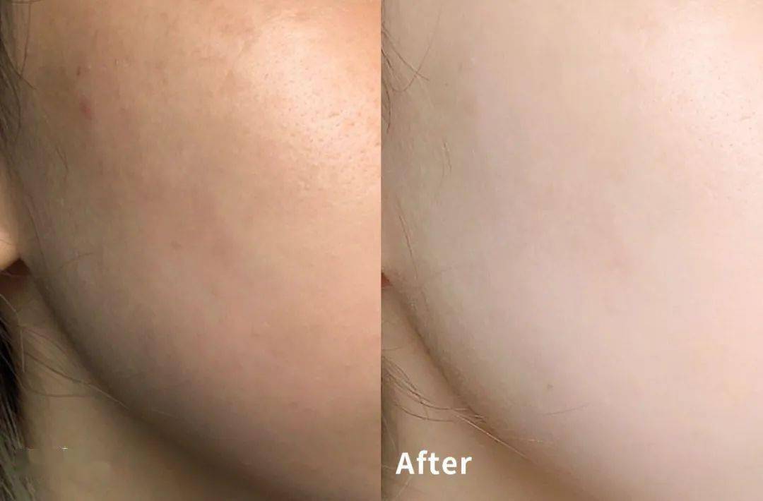 肌肤|40岁的逆袭 聪明的女人保鲜用这招