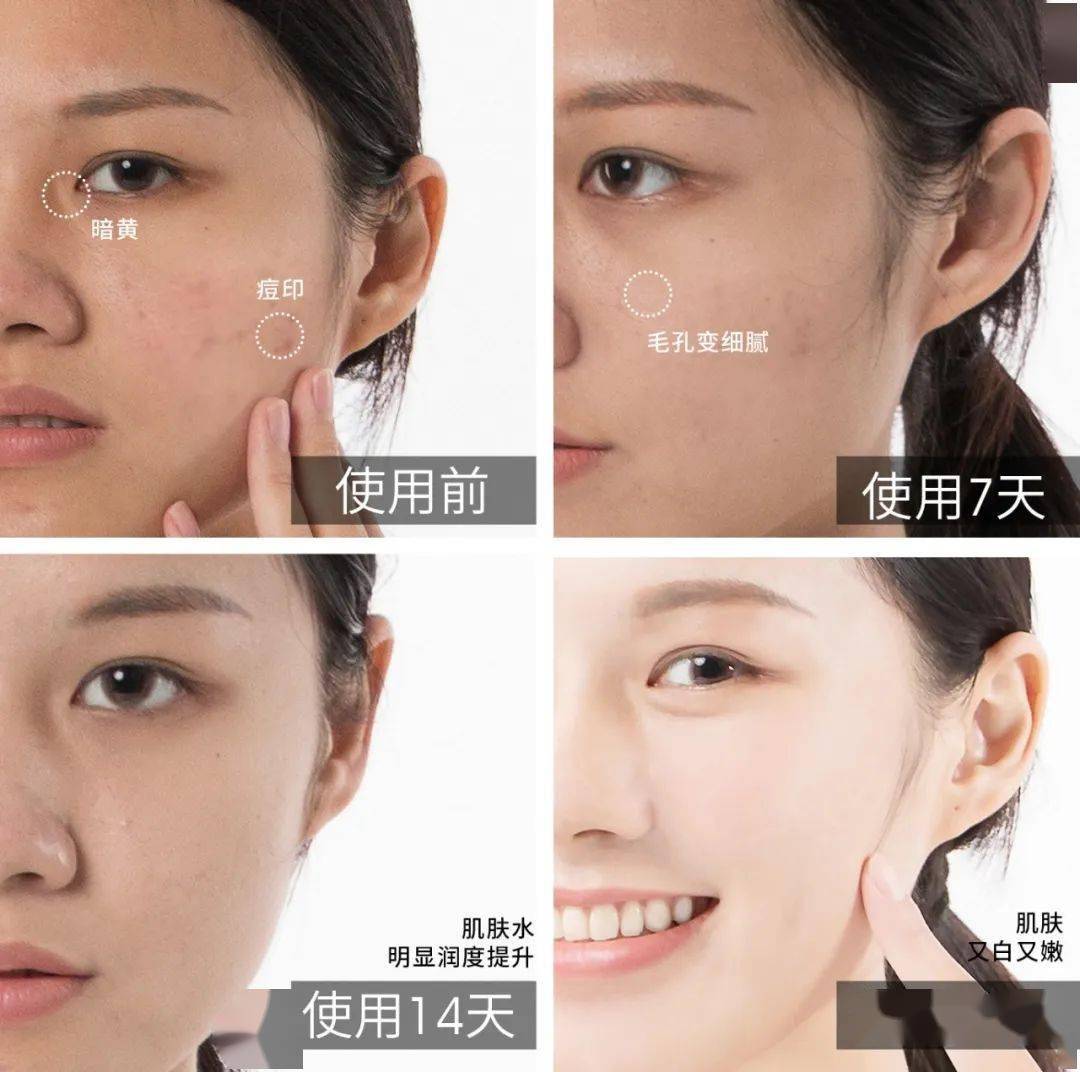 肌肤|40岁的逆袭 聪明的女人保鲜用这招