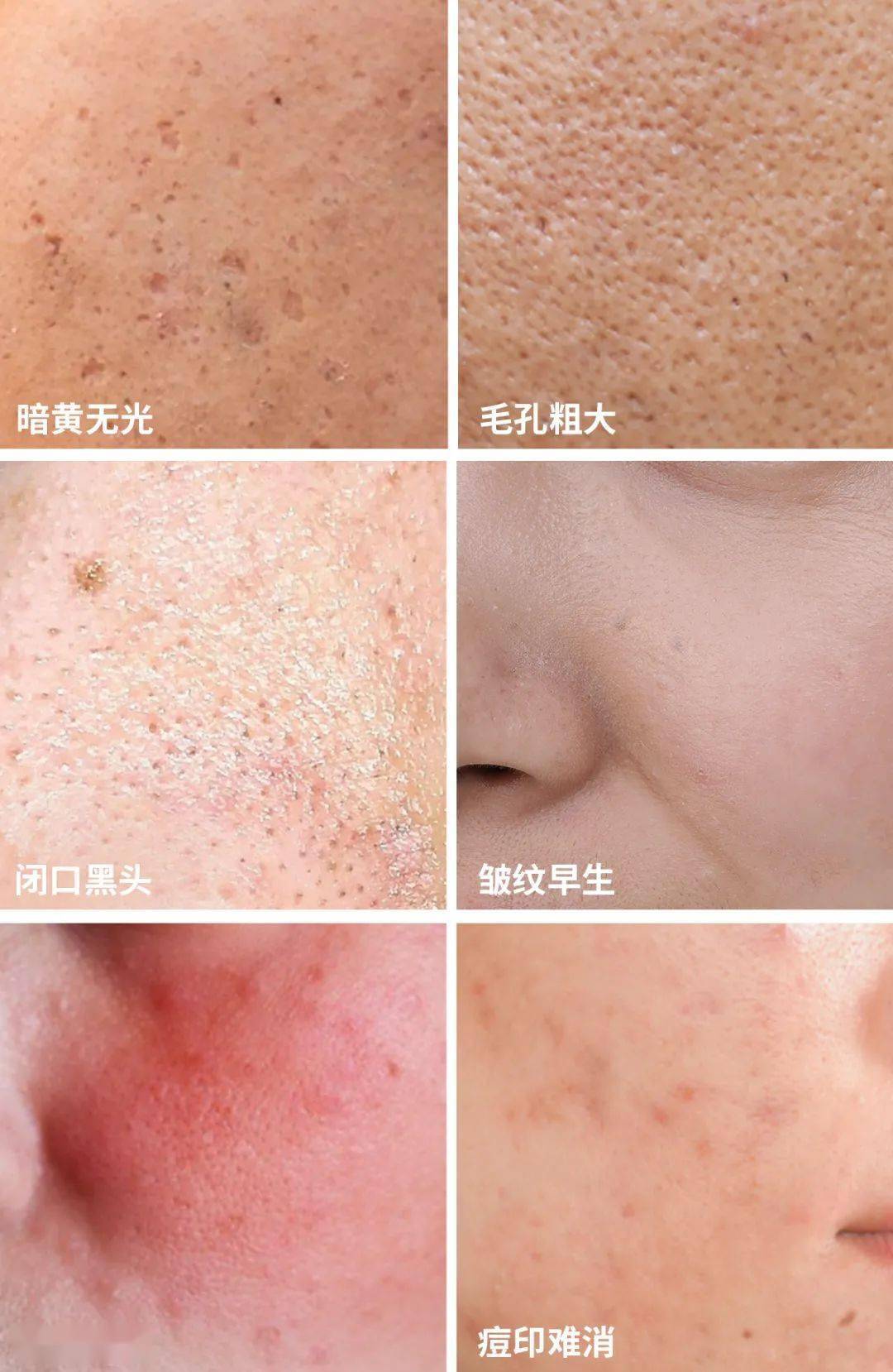 肌肤|40岁的逆袭 聪明的女人保鲜用这招