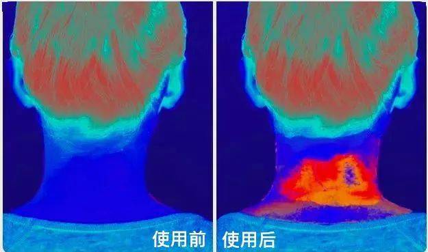 call|众明星打call～！能折叠放进口袋的按摩仪，随时拯救颈椎不适，真舒服！