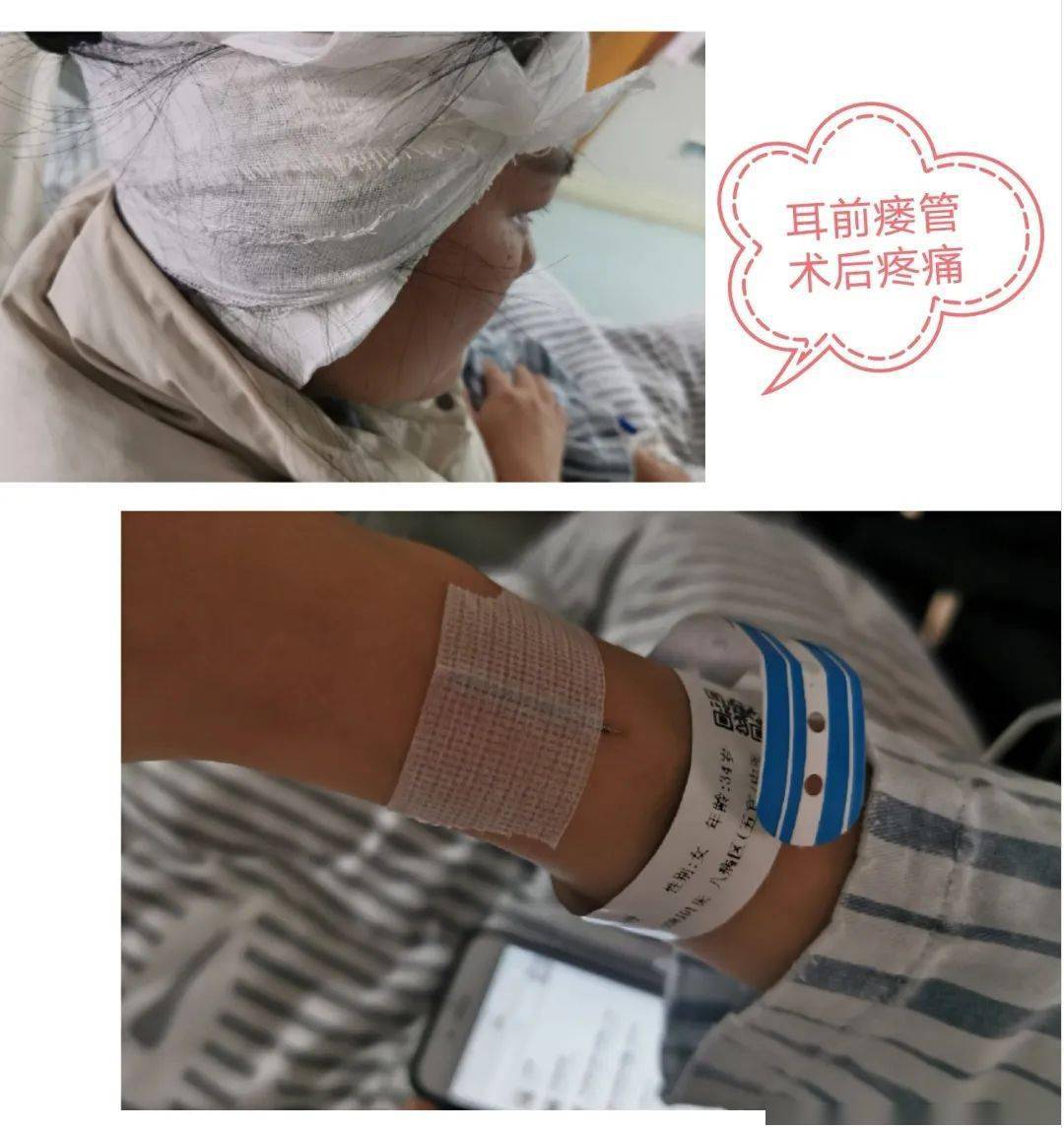 扎针不痛还能止痛?