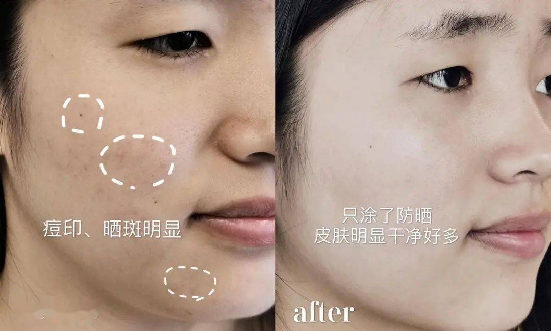 黑色素|薇娅直播间1分钟卖出10000瓶的美白精华，真的好用吗？