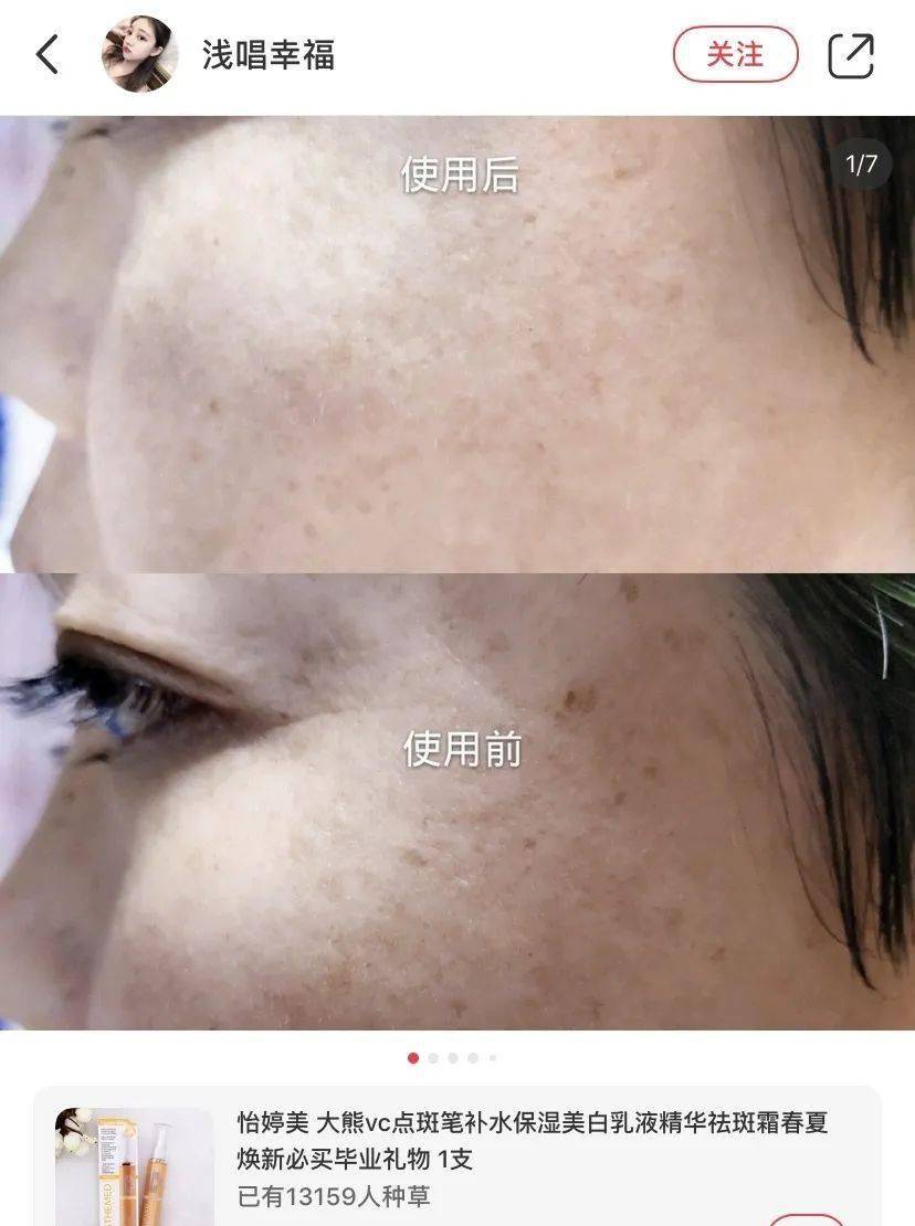 皮肤|用它点一点，痘印、斑点竟然没了，难怪李佳琦都为它疯狂打call！
