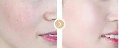 陈数|43岁的陈数演“女配”竟艳压女主佟丽娅,看了她的状态,我果断种草了这个东西......