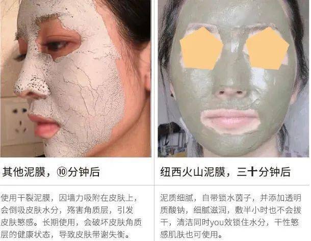 吸铁石|新西兰百年历史“污垢吸铁石”,15分钟告别黑头、粉刺、闭口!