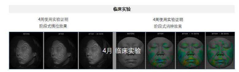 效果|这个比瘦脸针还好用的好物，既消水肿又提拉紧致，立变小V脸！