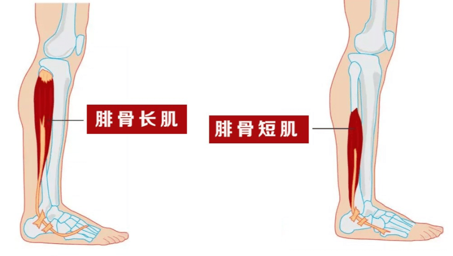 崴脚不可怕,最惨的是它还骨折了…_腓骨