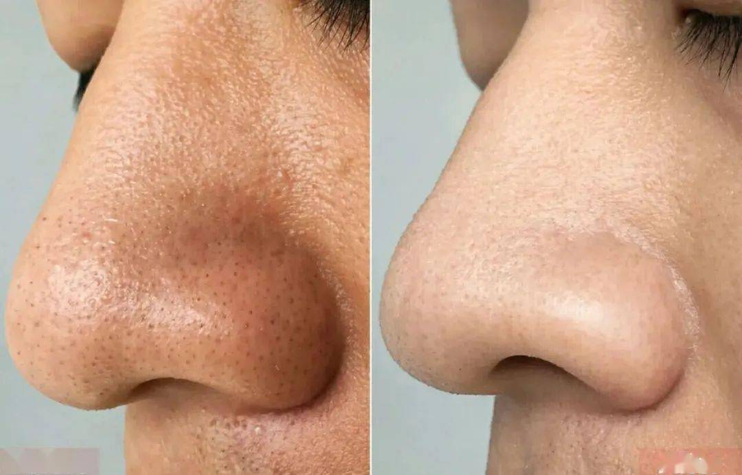 张天|张天爱比杨幂会“撩”?让小奶狗痴迷的她,到底有啥不一样?