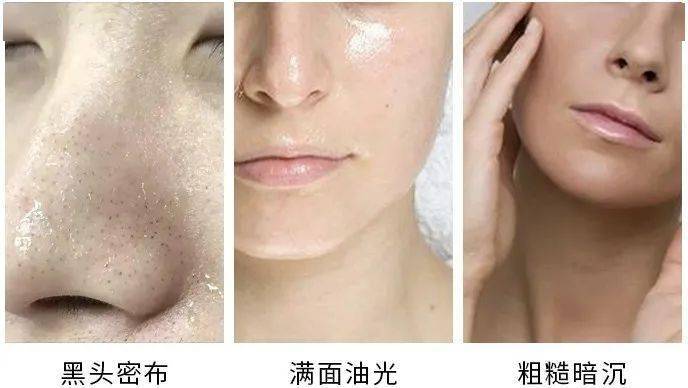 张天|张天爱比杨幂会“撩”?让小奶狗痴迷的她,到底有啥不一样?