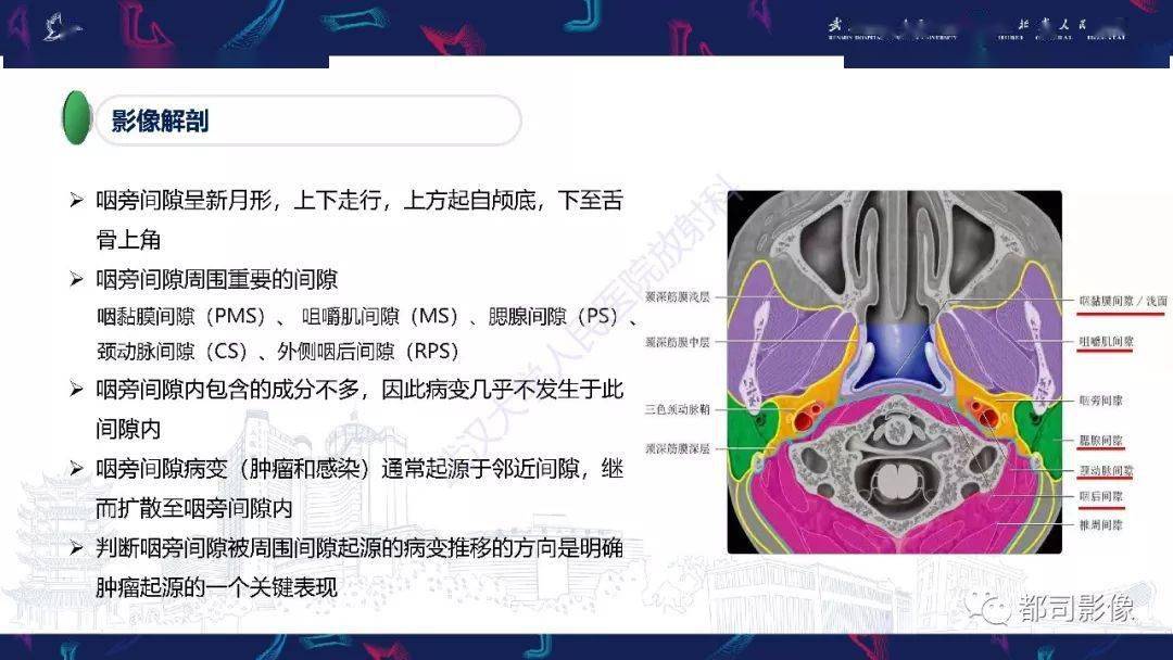 精彩推荐 | 咽旁间隙解剖及病变影像诊断