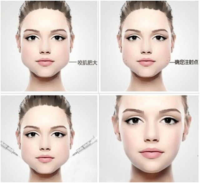 集体|比发福更可怕，人到中年为何集体“发腮”？