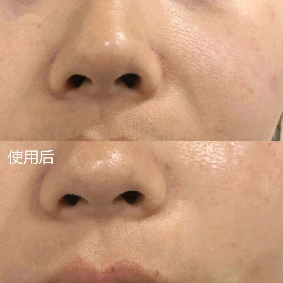 效果|震撼黑科技！搞定眼袋、细纹、浮肿、黑眼圈……效果比PS还好！