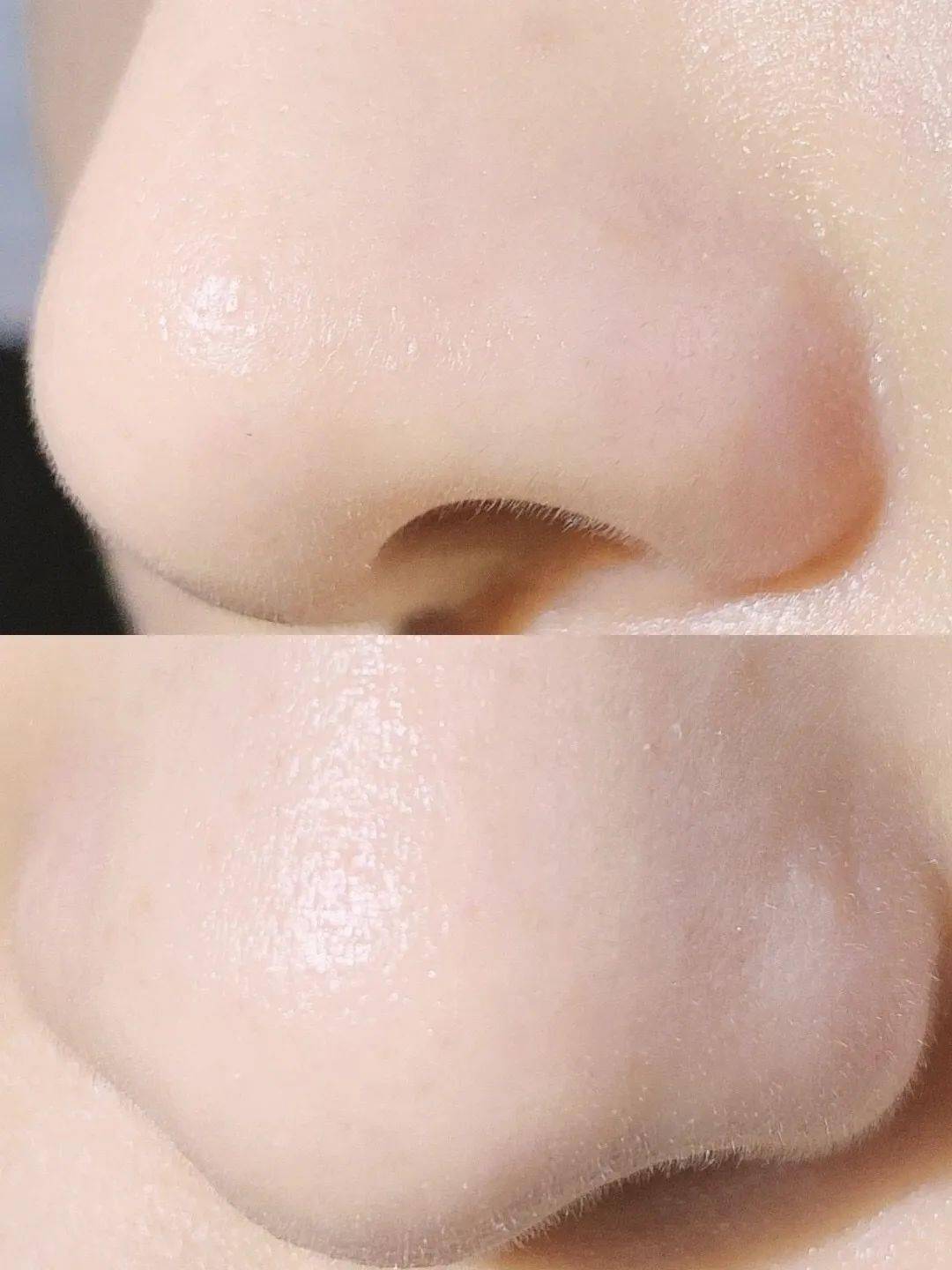 颜值再高也怕它,10倍放大毛孔,黑头清晰可见,这个可视化吸黑头仪太厉害了吧! 颜值再高也怕它,10倍放大毛孔,黑头清晰可见,这个可视化吸黑头仪太厉害了吧!