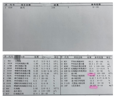 感冒你错了是川崎病