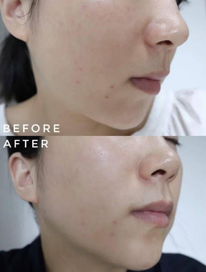 兰蔻平|测评|兰蔻平替的欧莱雅精华,真的夸腻了!