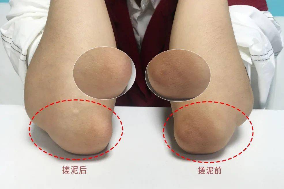 角质|薇娅吹爆的这款磨砂膏,我替你们试了,用完蚊子能在背上劈叉!