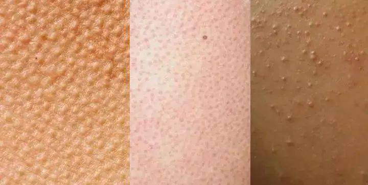 皮肤|想知道如何让肌肤常驻18岁吗？想知道明星三四十岁依然拥有靓丽肌肤吗？点进来我告诉你