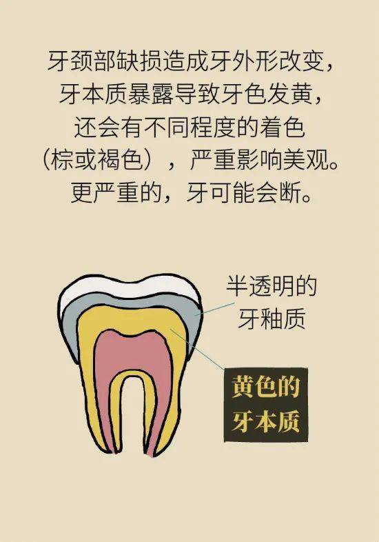 梦见牙齿整100天掉了，探索梦境背后的深层含义与心理解析