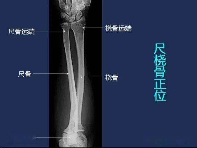 影像解剖全身常规x线骨关节mri断层解剖大全