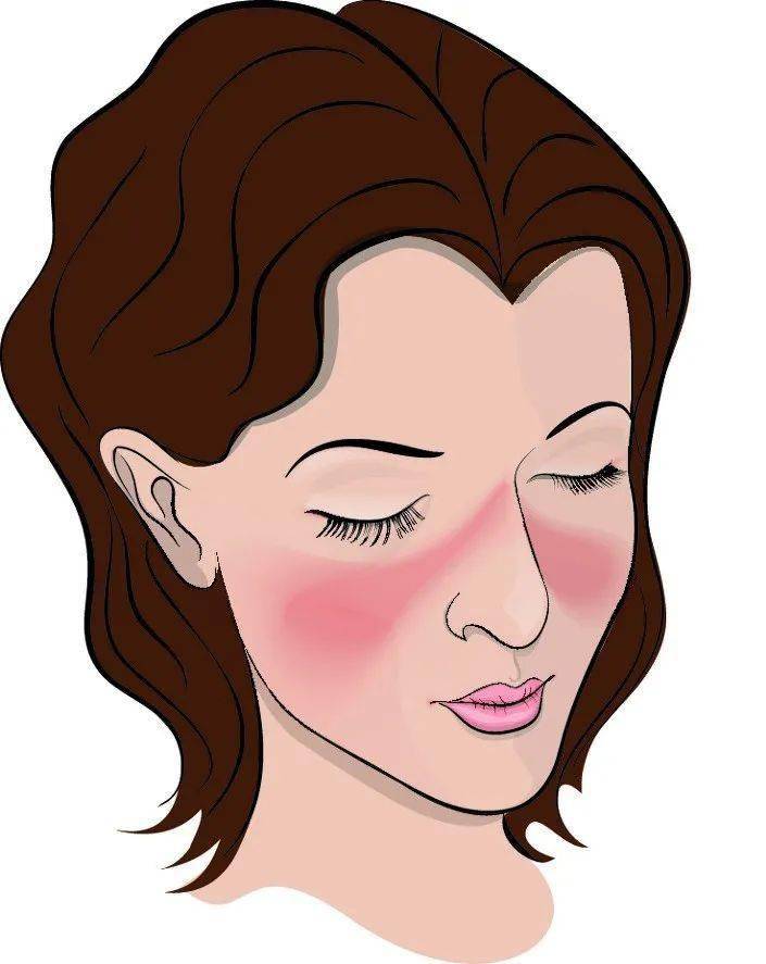 患者|奇怪！这个病“专盯”年轻漂亮女性，要当心了，否则后果严重！