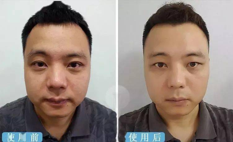 方法|眼袋显老又显丑，教你一方法轻松干掉它！！