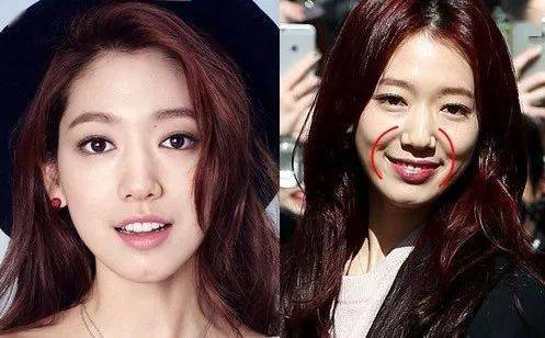 皱纹|抗皱抗衰老还在打针?用它赶走三八脸、鱼尾纹,让小朋友见到你都喊姐姐!