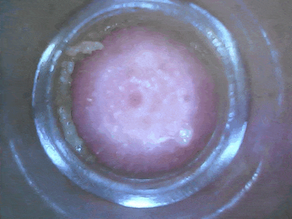 黑头|【超多干货！】对黑头粉刺无从下手？没有它，毛孔越弄越粗大！