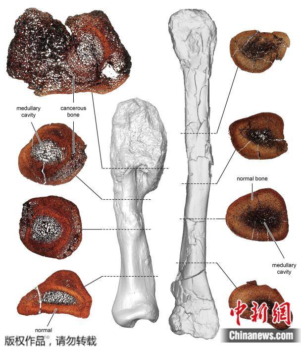 骨癌|首次！科学家在有角恐龙化石中诊断出恶性肿瘤