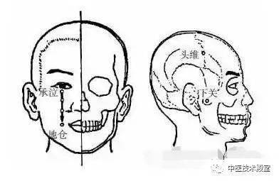 怎样才能有效的治疗三叉神经痛 9239028ca97f4f66b56d12565c9ba06a.jpeg