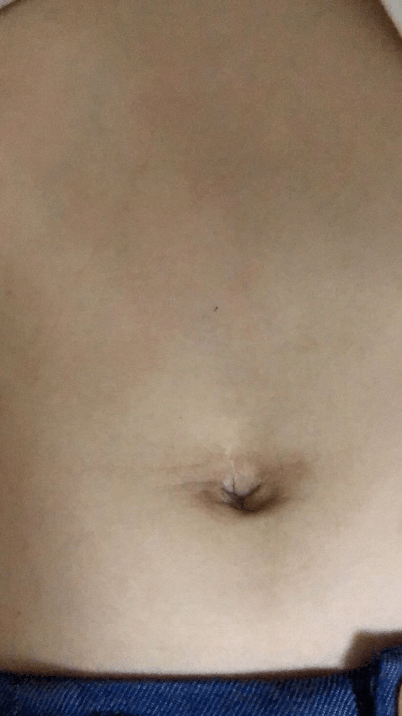 怀双胞胎肚子大小 aba5ddc83de04c0684fbd669c02ff8a6.png