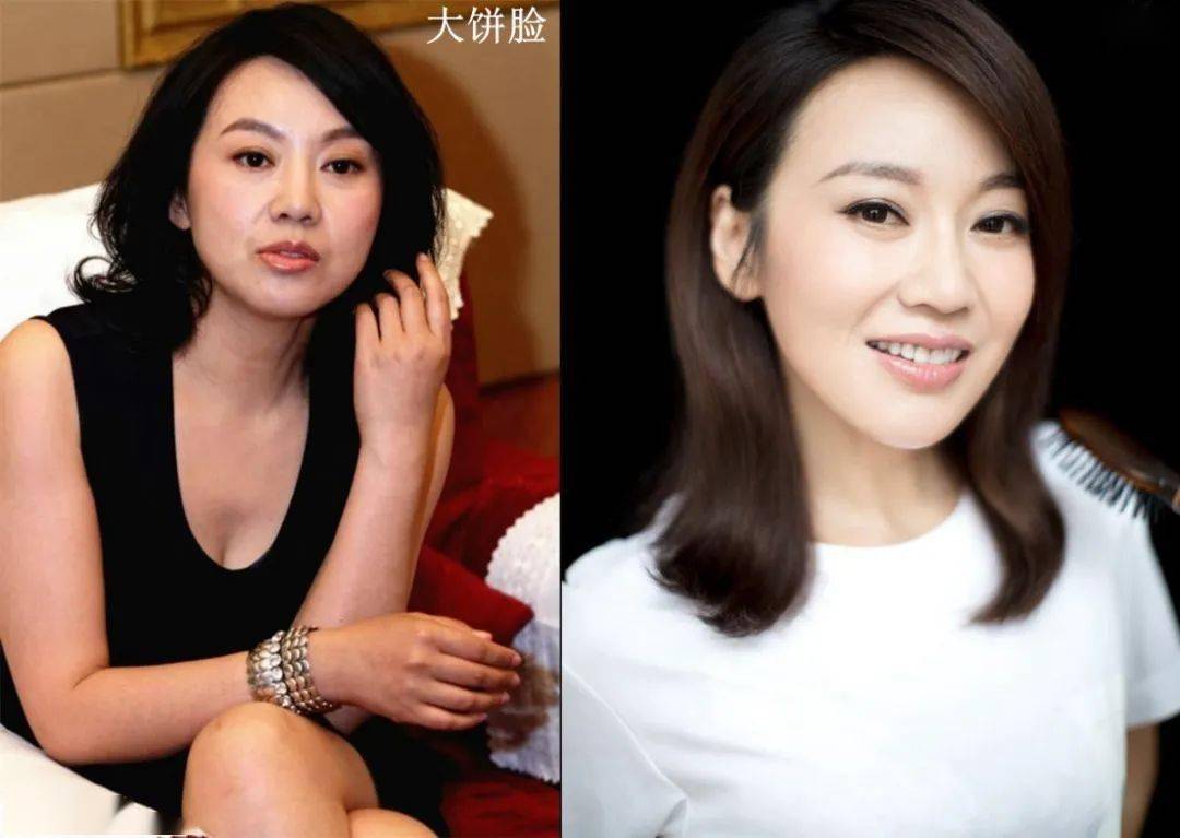 提拉|明星都在用的V脸面膜，有它谁还打瘦脸针！