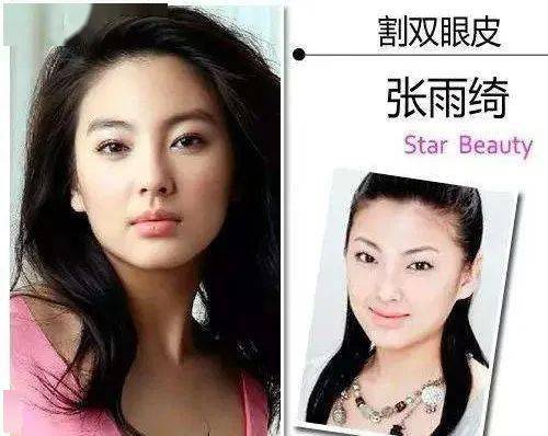 桃仔|整容黑历史都自曝了,景甜真是个狠人啊!