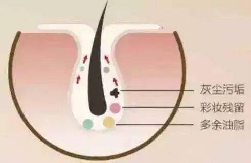 氨基酸|这支平价洗面奶，竟然可以洗掉痘痘，还你清透肌？！