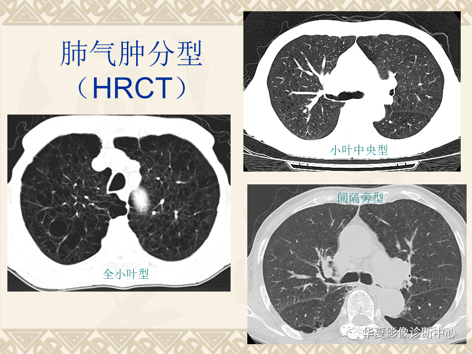 影像基础课丨肺气肿及气道疾病的影像学表现