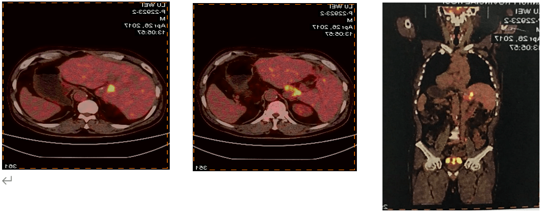 中欧专家以病例为鉴,多角度共话2020年