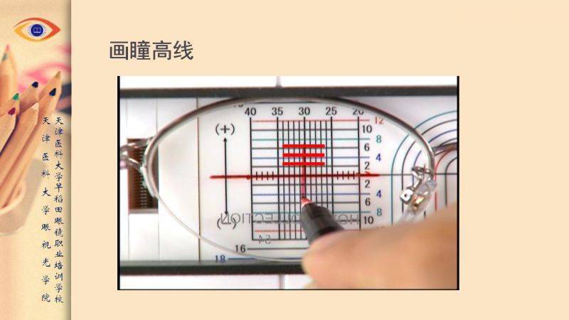 【眼视光】 瞳高的测量方法