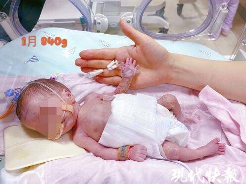 无锡|出生仅一瓶矿泉水重！无锡530克早产宝宝救治成功