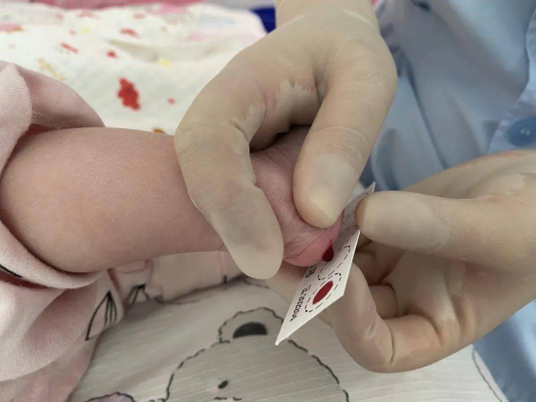 您知道宝宝为什么要在出生后的72小时内采足底血吗