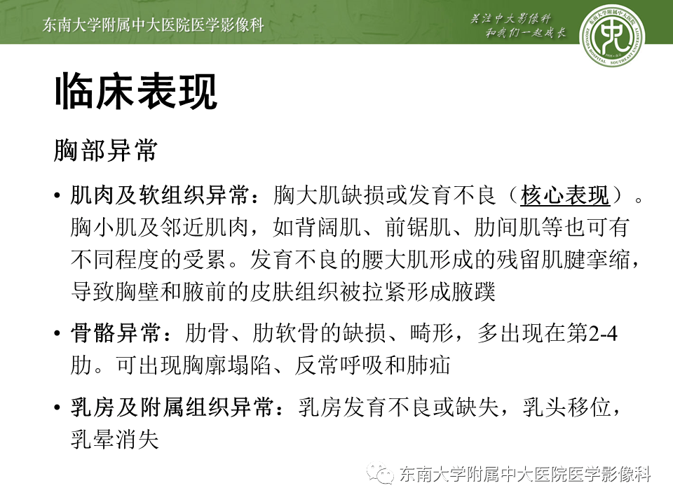 肌骨系统疾病poland综合征