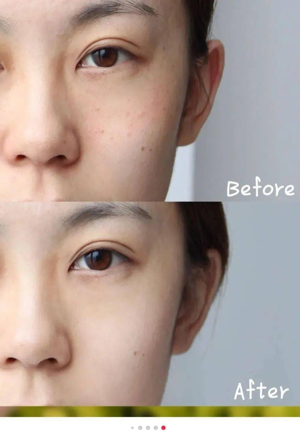 肌肤|40岁的年龄，18岁的脸，深扒“金喜善们”的冻龄术，竟然都是它！