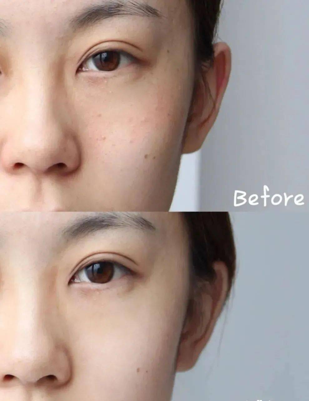 肌肤|40岁的年龄，18岁的脸，深扒“金喜善们”的冻龄术，竟然都是它！