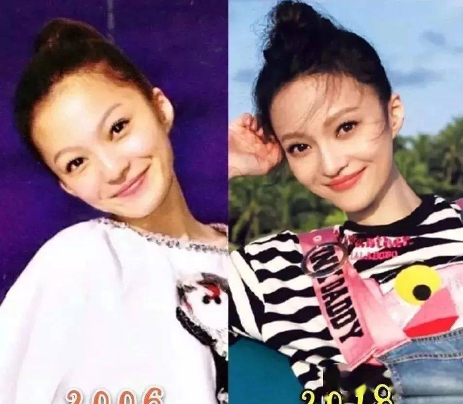 肌肤|40岁的年龄，18岁的脸，深扒“金喜善们”的冻龄术，竟然都是它！